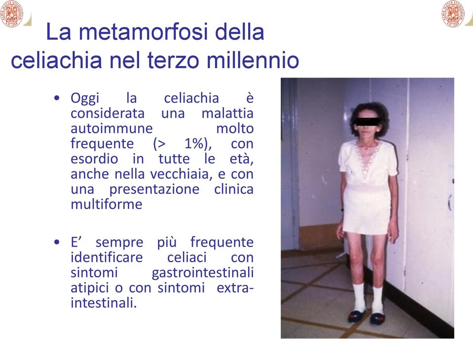 nella vecchiaia, e con una presentazione clinica multiforme E sempre più frequente