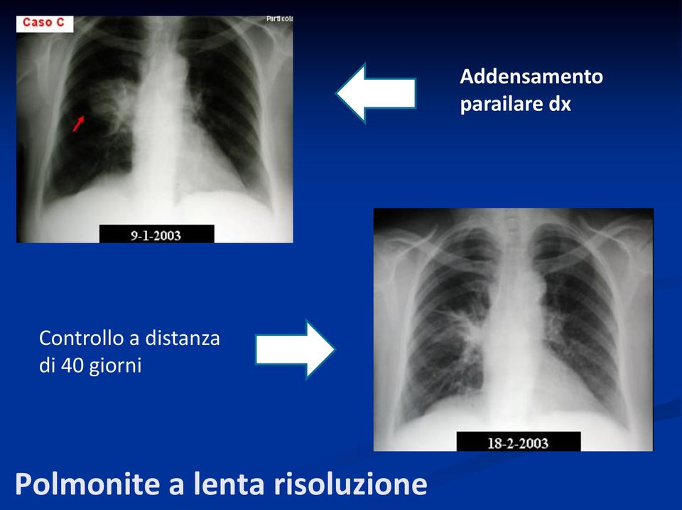 distanza di 40 giorni