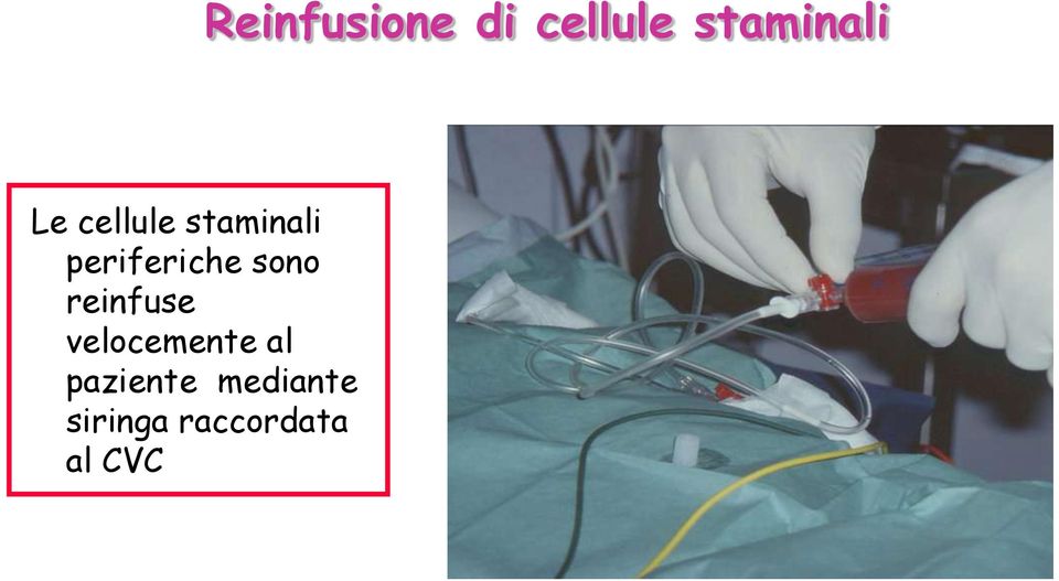 paziente mediante siringa