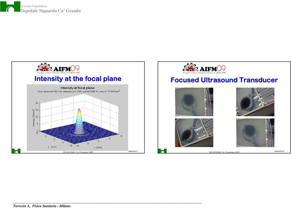 Ultrasound Transducer