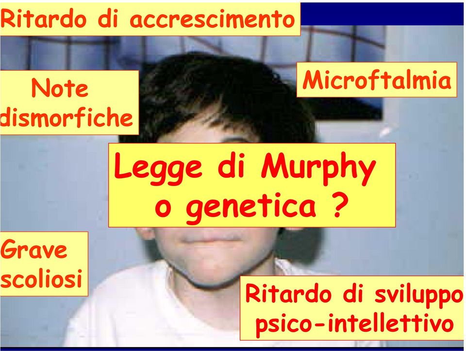 Murphy o genetica?