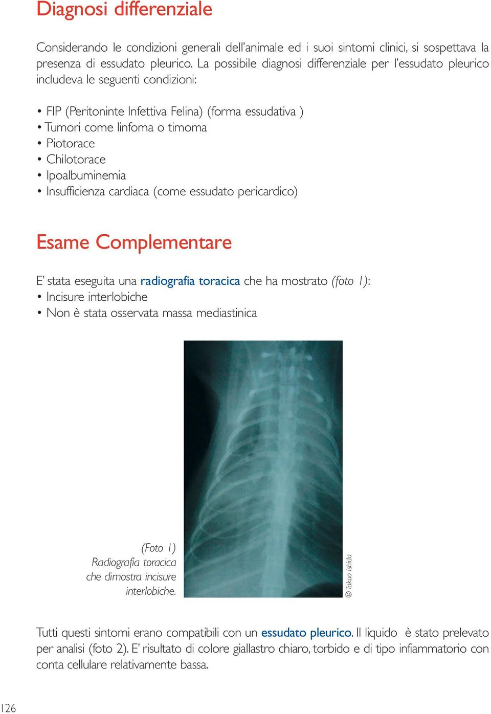 Ipoalbuminemia Insufficienza cardiaca (come essudato pericardico) Esame Complementare E stata eseguita una radiografia toracica che ha mostrato (foto 1): Incisure interlobiche Non è stata osservata