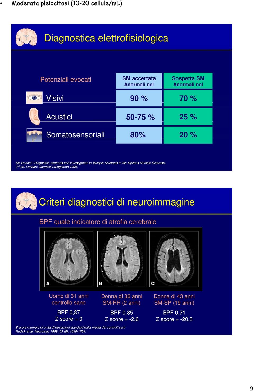 Criteri diagnostici di neuroimmagine BPF quale indicatore di atrofia cerebrale Uomo di 3 anni controllo sano BPF 0,87 Z score = 0 Donna di 36 anni SM-RR ( anni) BPF 0,85 Z score