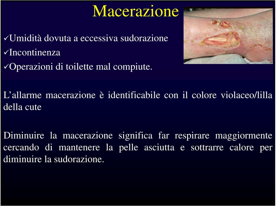 L allarme macerazione è identificabile con il colore violaceo/lilla della cute