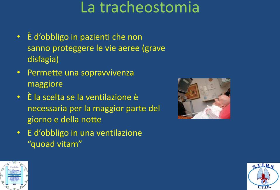 È la scelta se la ventilazione è necessaria per la maggior parte