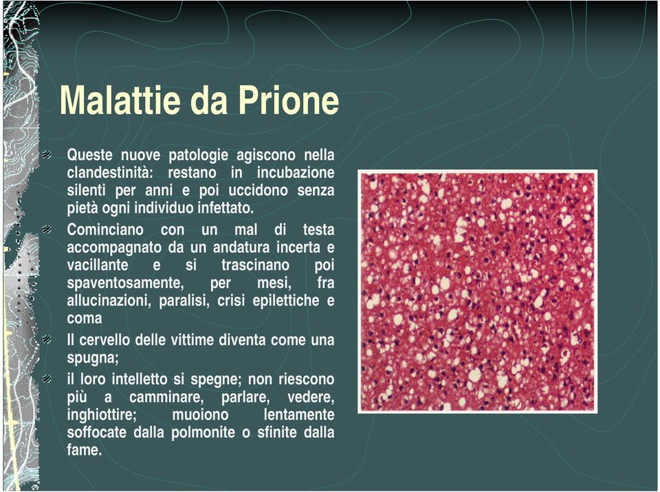 Cominciano con un mal di testa accompagnato da un andatura incerta e vacillante e si trascinano poi spaventosamente, per mesi, fra