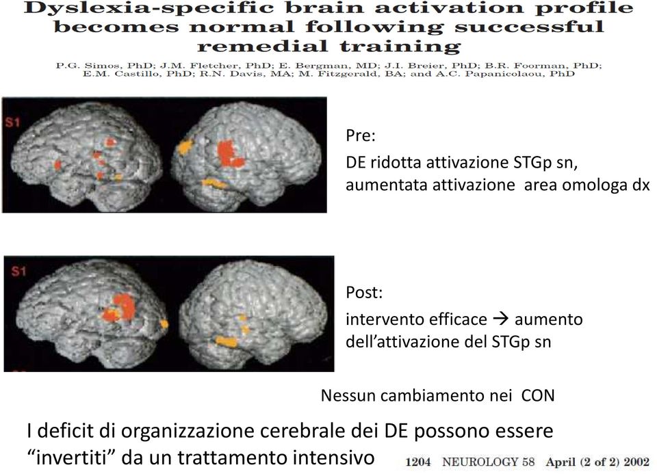 STGp sn Nessun cambiamento nei CON I deficit di organizzazione