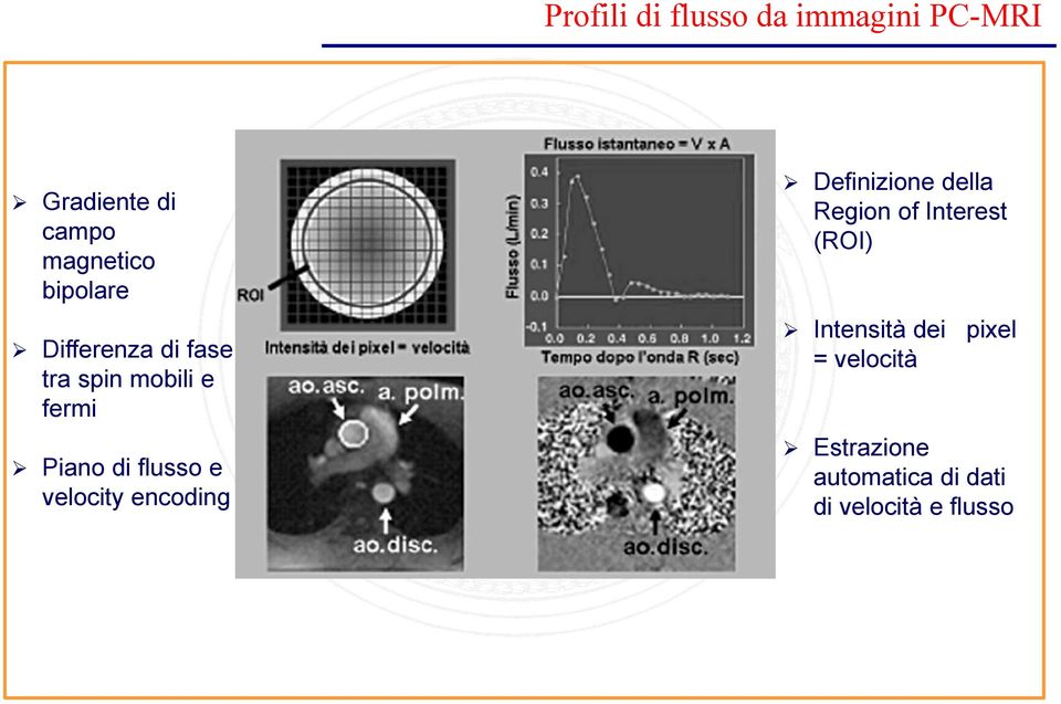 velocity encoding Definizione della Region of Interest (ROI)