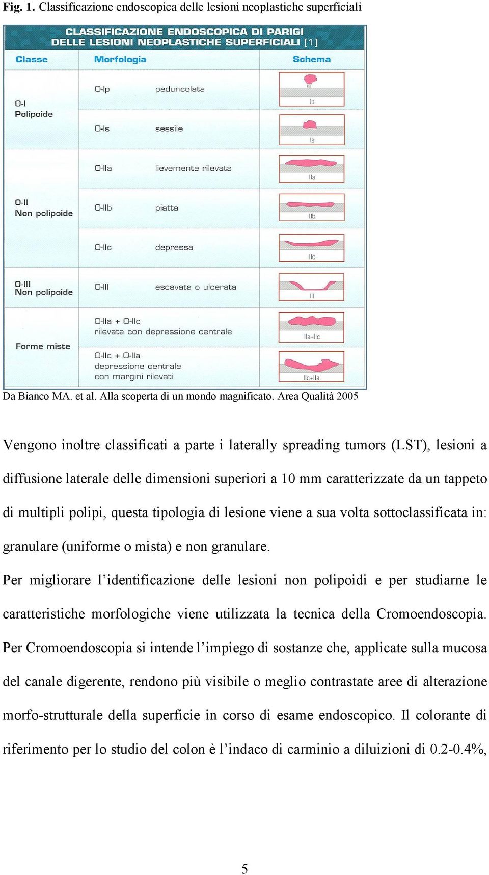 polipi, questa tipologia di lesione viene a sua volta sottoclassificata in: granulare (uniforme o mista) e non granulare.