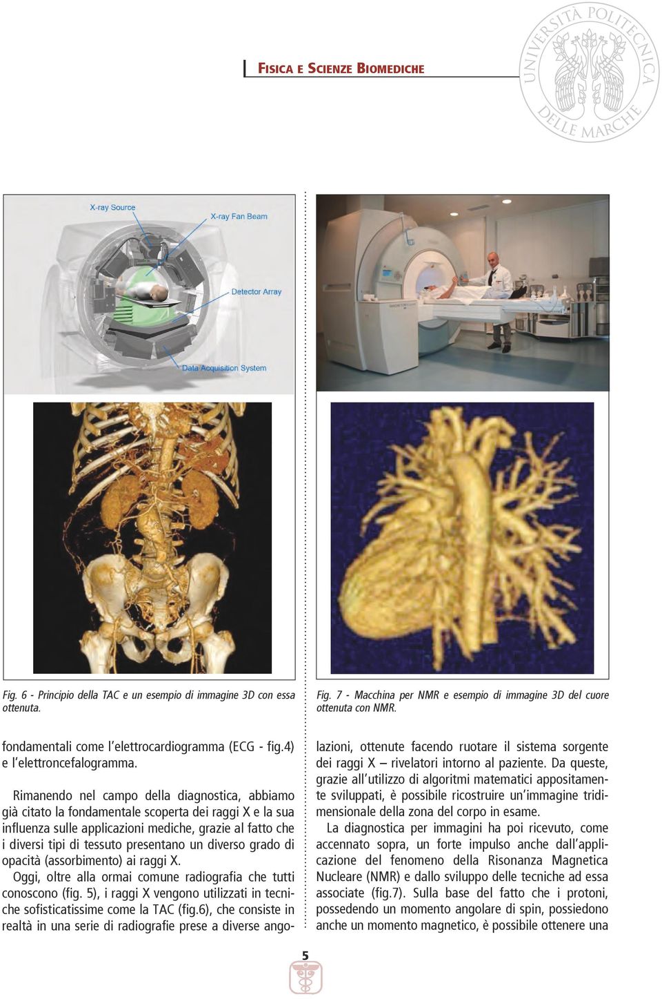 Da queste, grazie all utilizzo di algoritmi matematici appositamente sviluppati, è possibile ricostruire un immagine tridimensionale della zona del corpo in esame.