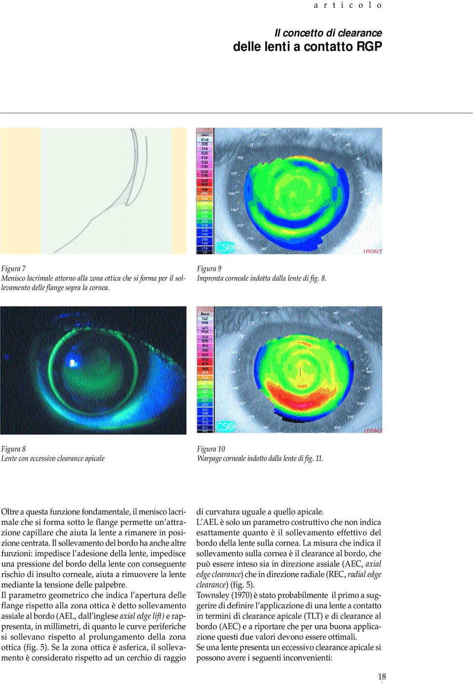 Oltre a questa funzione fondamentale, il menisco lacrimale che si forma sotto le flange permette un attrazione capillare che aiuta la lente a rimanere in posizione centrata.