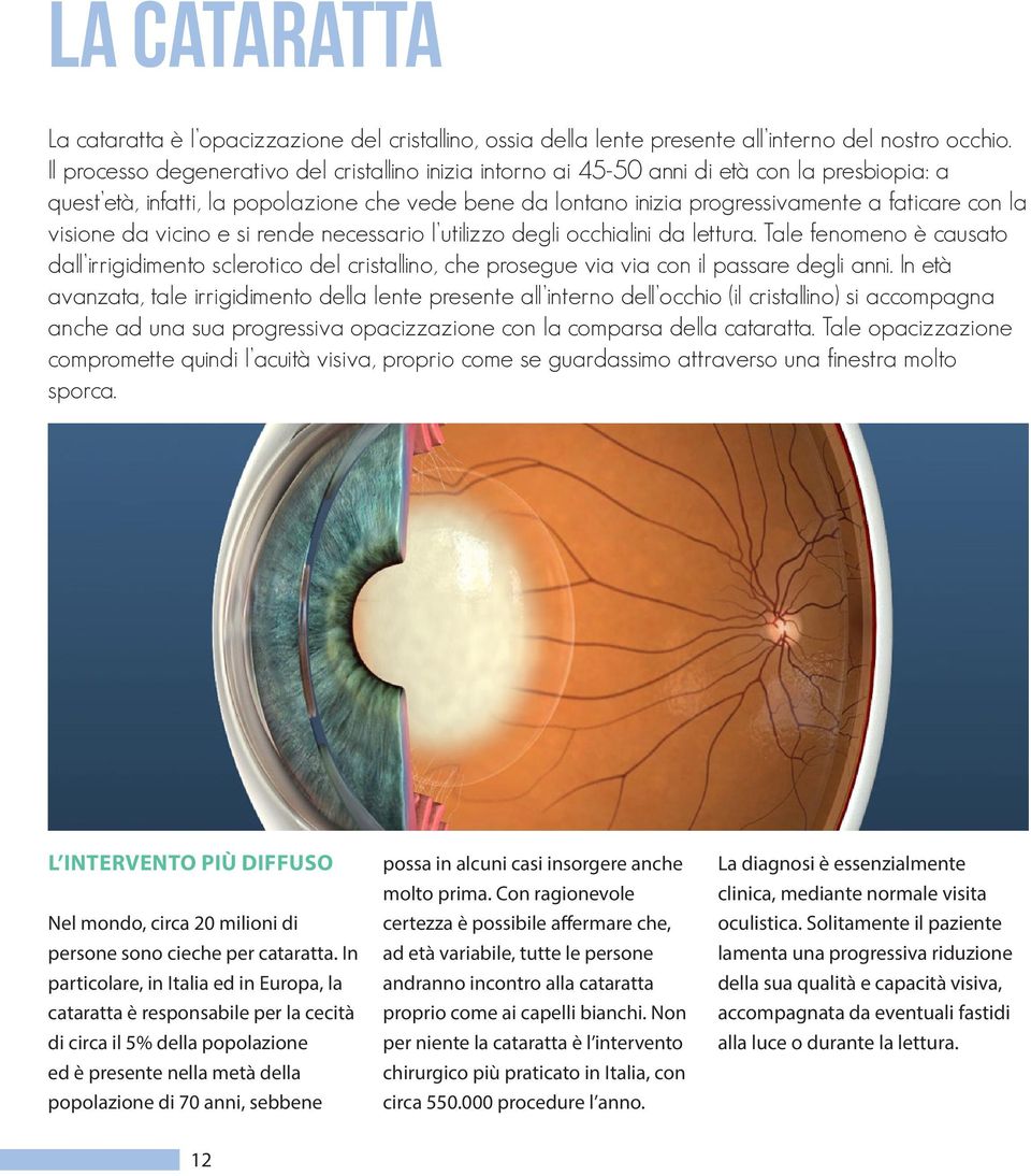 visione da vicino e si rende necessario l utilizzo degli occhialini da lettura. Tale fenomeno è causato dall irrigidimento sclerotico del cristallino, che prosegue via via con il passare degli anni.