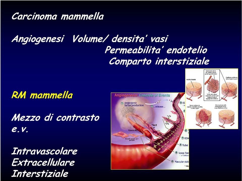 interstiziale RM mammella Mezzo di contrasto