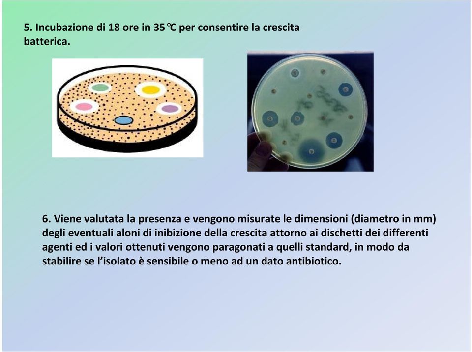 aloni di inibizione della crescita attorno ai dischetti dei differenti agenti ed i valori