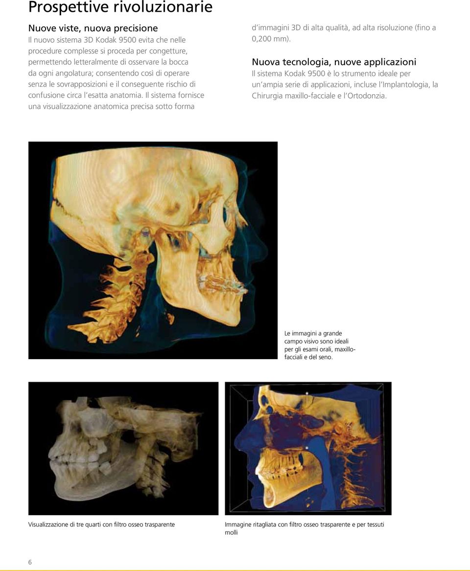 Il sistema fornisce una visualizzazione anatomica precisa sotto forma d immagini 3D di alta qualità, ad alta risoluzione (fino a 0,200 mm).