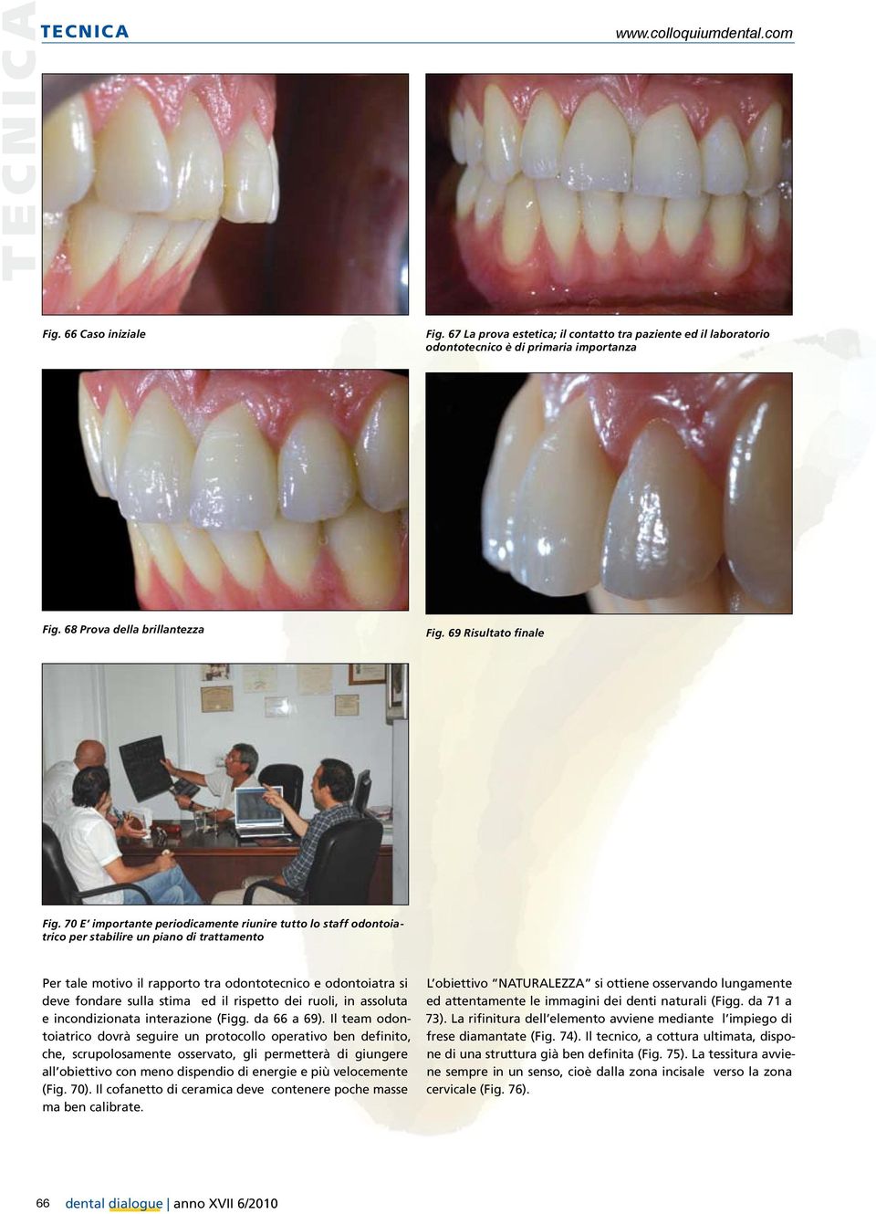 70 E importante periodicamente riunire tutto lo staff odontoiatrico per stabilire un piano di trattamento Per tale motivo il rapporto tra odontotecnico e odontoiatra si deve fondare sulla stima ed il