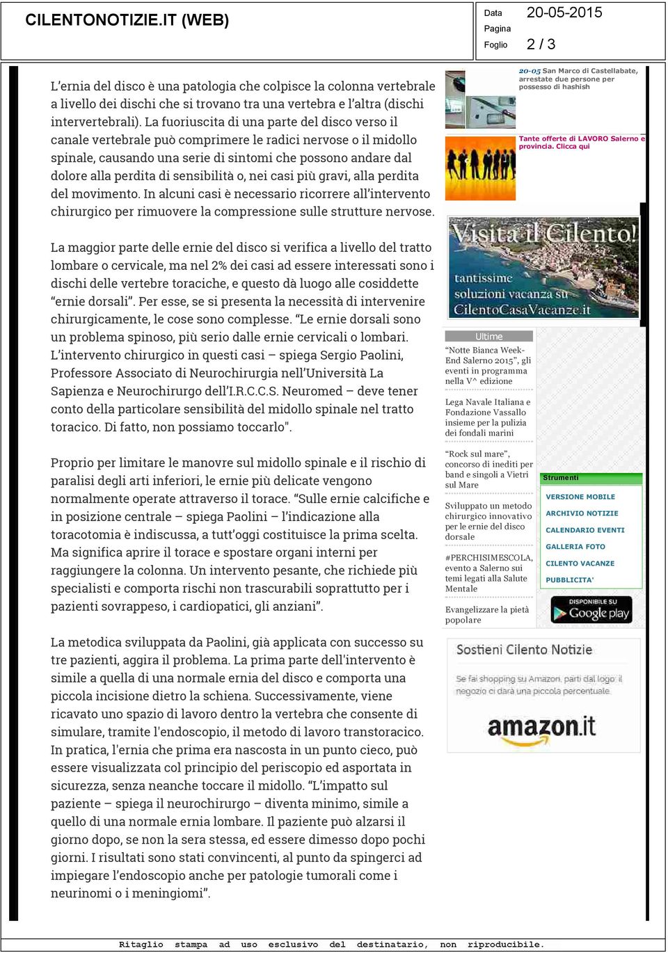 sensibilità o, nei casi più gravi, alla perdita del movimento. In alcuni casi è necessario ricorrere all intervento chirurgico per rimuovere la compressione sulle strutture nervose.