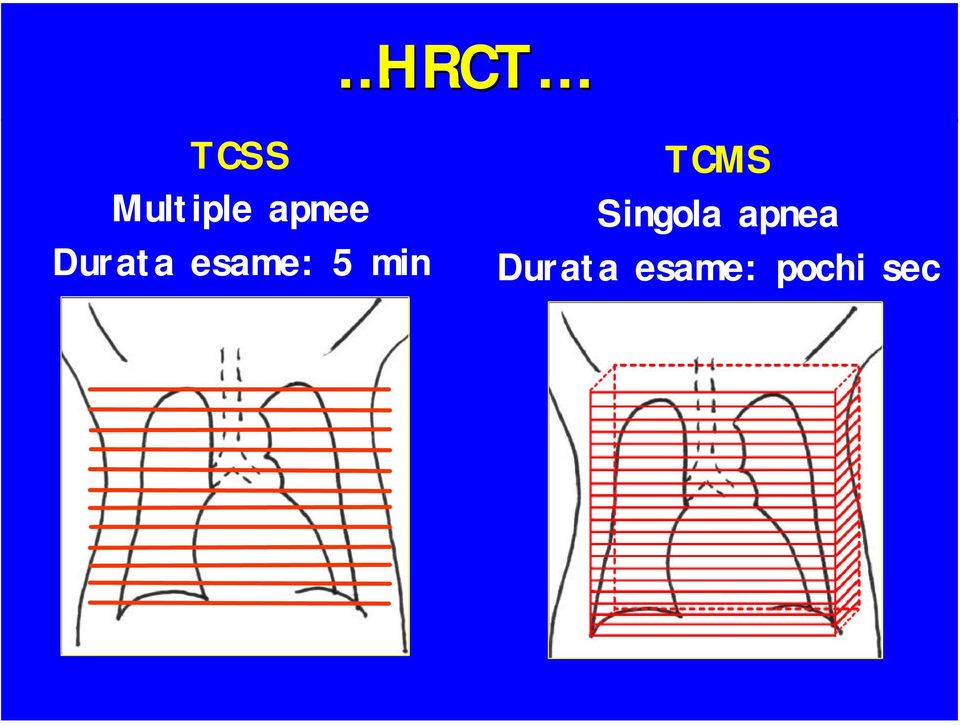 min TCMS Singola