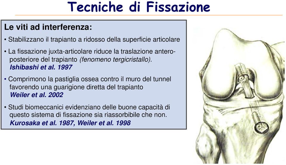 1997! Comprimono la pastiglia ossea contro il muro del tunnel favorendo una guarigione diretta del trapianto Weiler et al. 2002!
