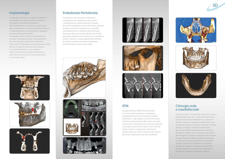 del tessuto adiacente delle caratteristiche di un sito mandibolare edentulo al dente, necessita di immagini con una qualità e l individuazione di un potenziale sito implantare estremamente alta, in