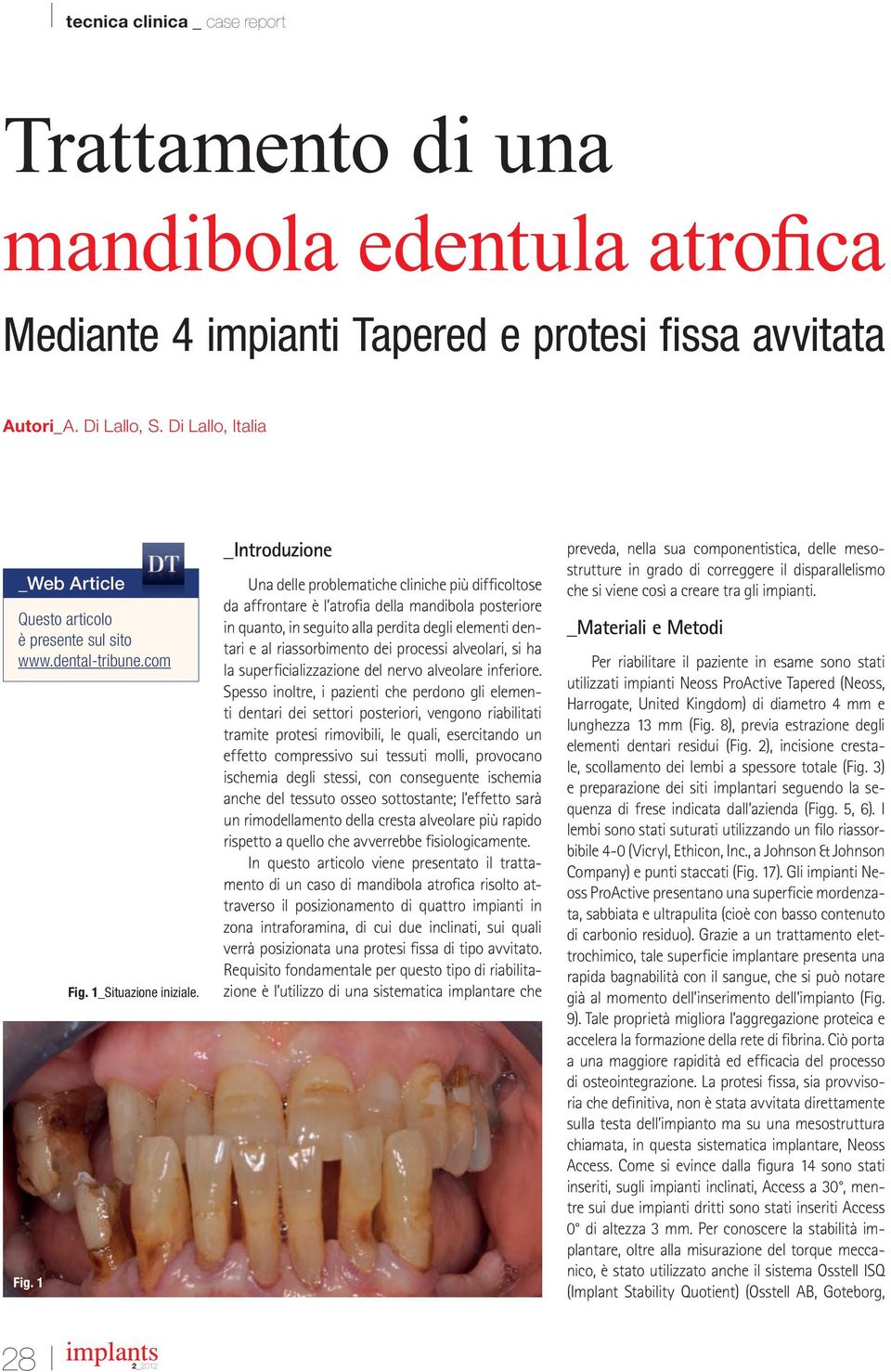 _Introduzione Una delle problematiche cliniche più difficoltose da affrontare è l atrofia della mandibola posteriore in quanto, in seguito alla perdita degli elementi dentari e al riassorbimento dei