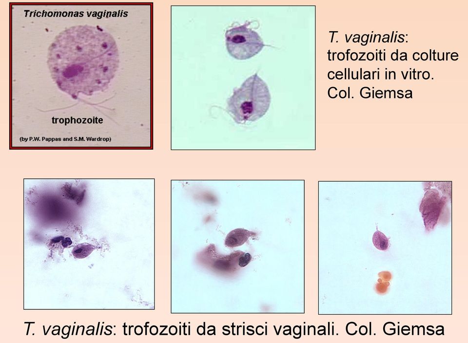 Giemsa  strisci vaginali. Col.