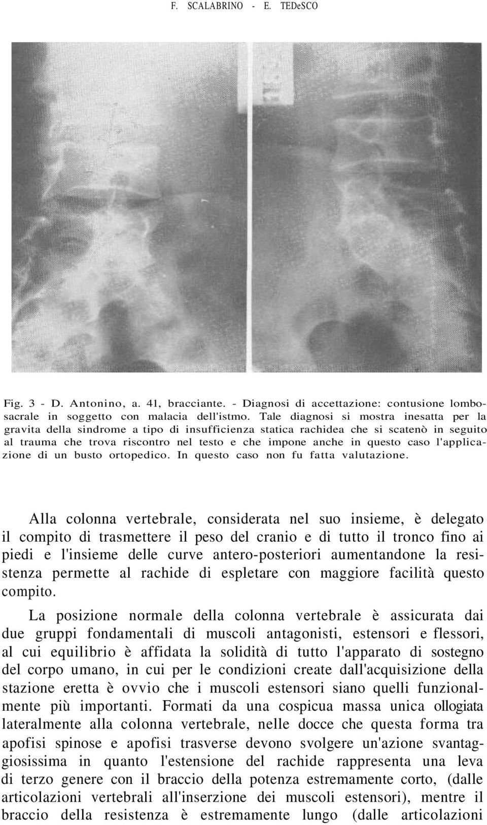 caso l'applicazione di un busto ortopedico. In questo caso non fu fatta valutazione.