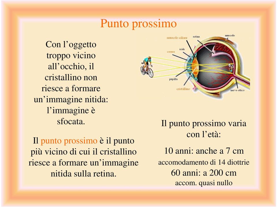 Il punto prossimo è il punto più vicino di cui il cristallino riesce a formare un immagine