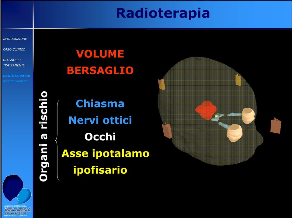 Chiasma Nervi ottici