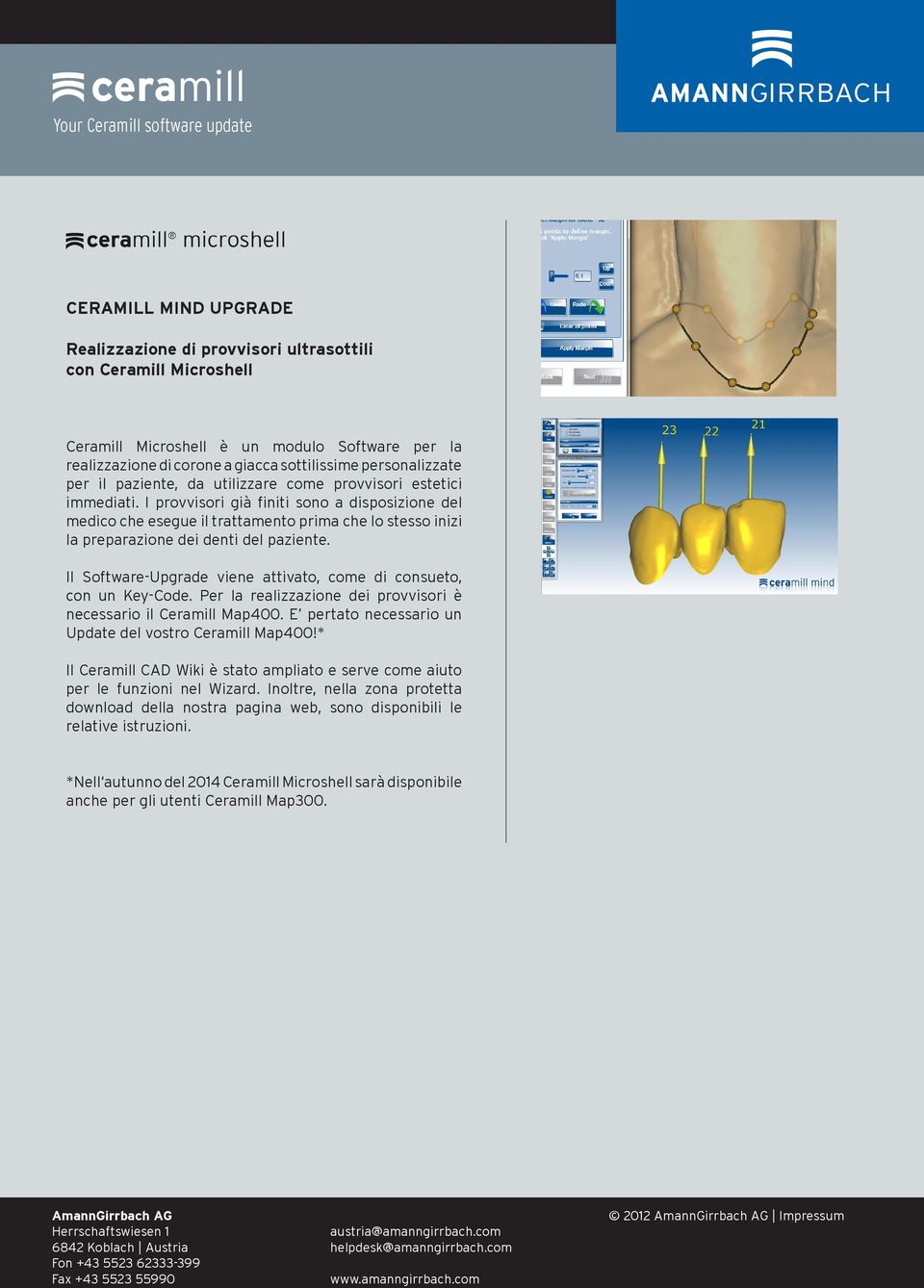 I provvisori già finiti sono a disposizione del medico che esegue il trattamento prima che lo stesso inizi la preparazione dei denti del paziente.