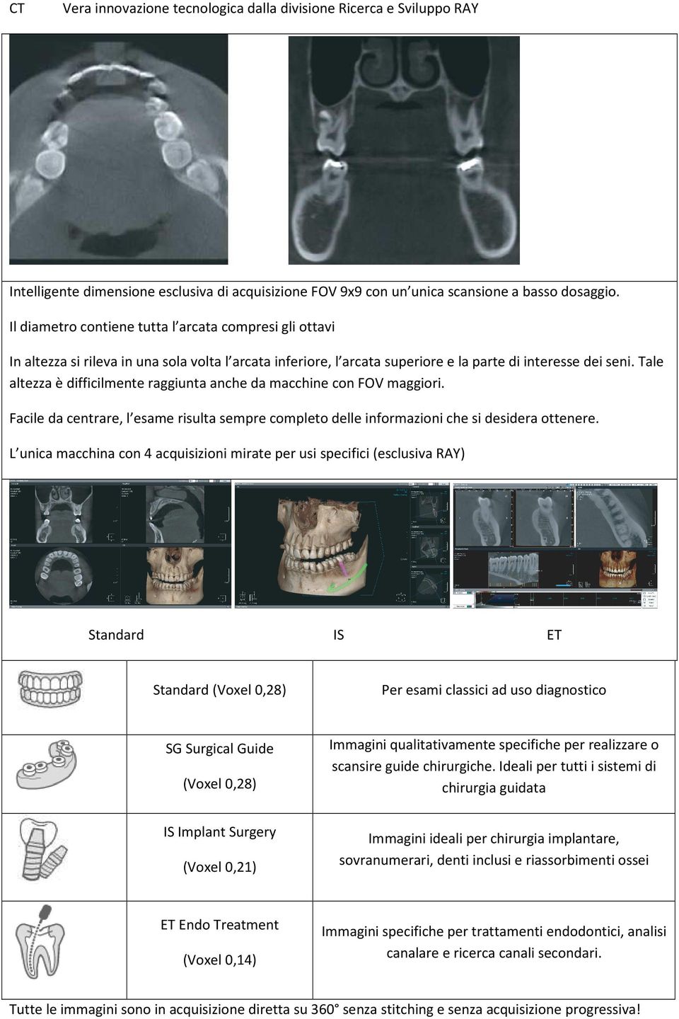 Tale altezza è difficilmente raggiunta anche da macchine con FOV maggiori. Facile da centrare, l esame risulta sempre completo delle informazioni che si desidera ottenere.