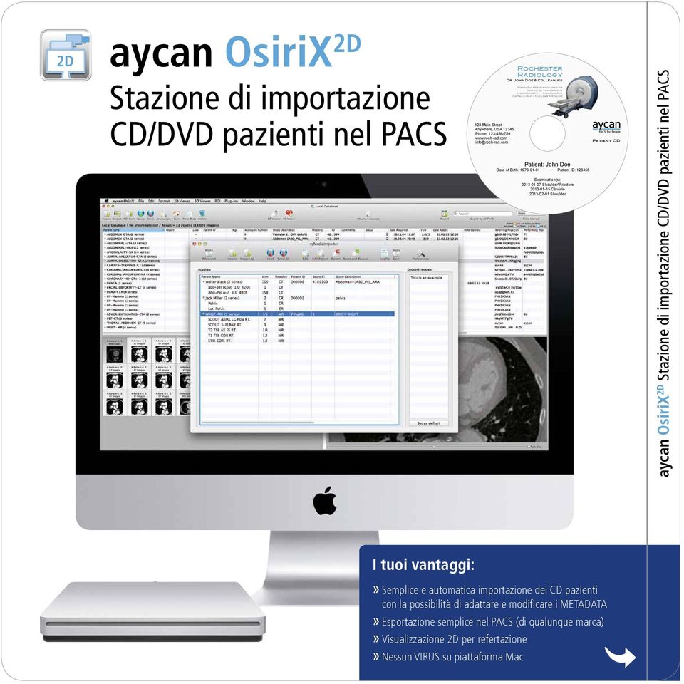 Examination(s): 2013-01-07 Shoulder*Fracture 2013-01-15 Clavicle 2013-02-01 Shoulder Patient CD aycan OsiriX 2D Stazione di importazione CD/DVD pazienti nel PACS I tuoi vantaggi:» Semplice e