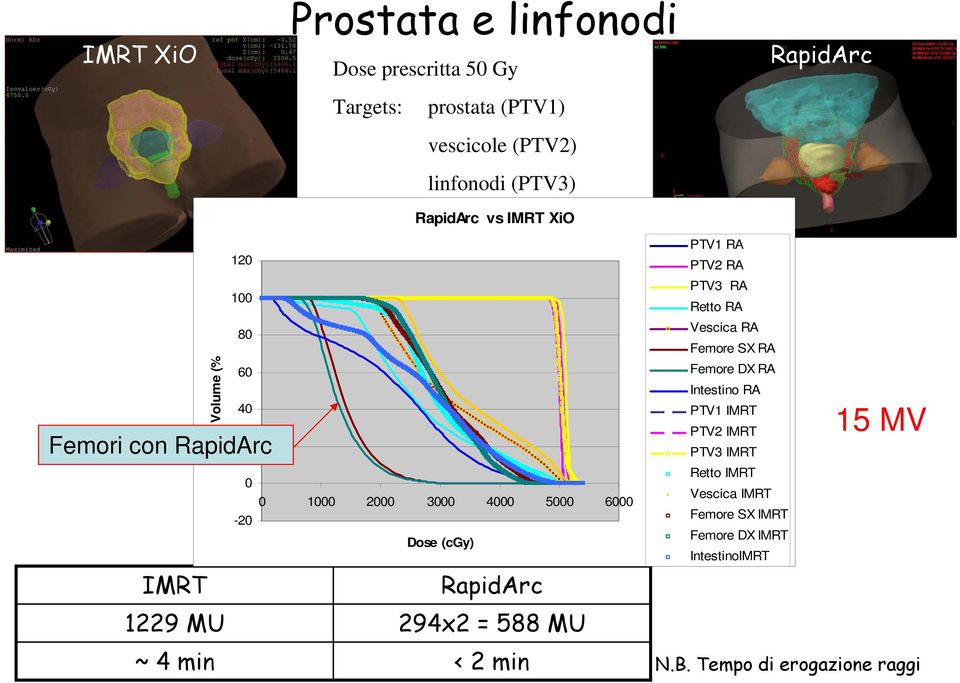 1229 MU 294x2 = 588 MU ~ 4 min < 2 min PTV1 RA PTV2 RA PTV3 RA Retto RA Vescica RA Femore SX RA Femore DX RA Intestino RA PTV1