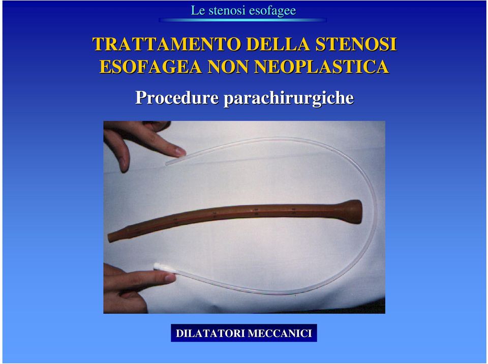 NEOPLASTICA Procedure