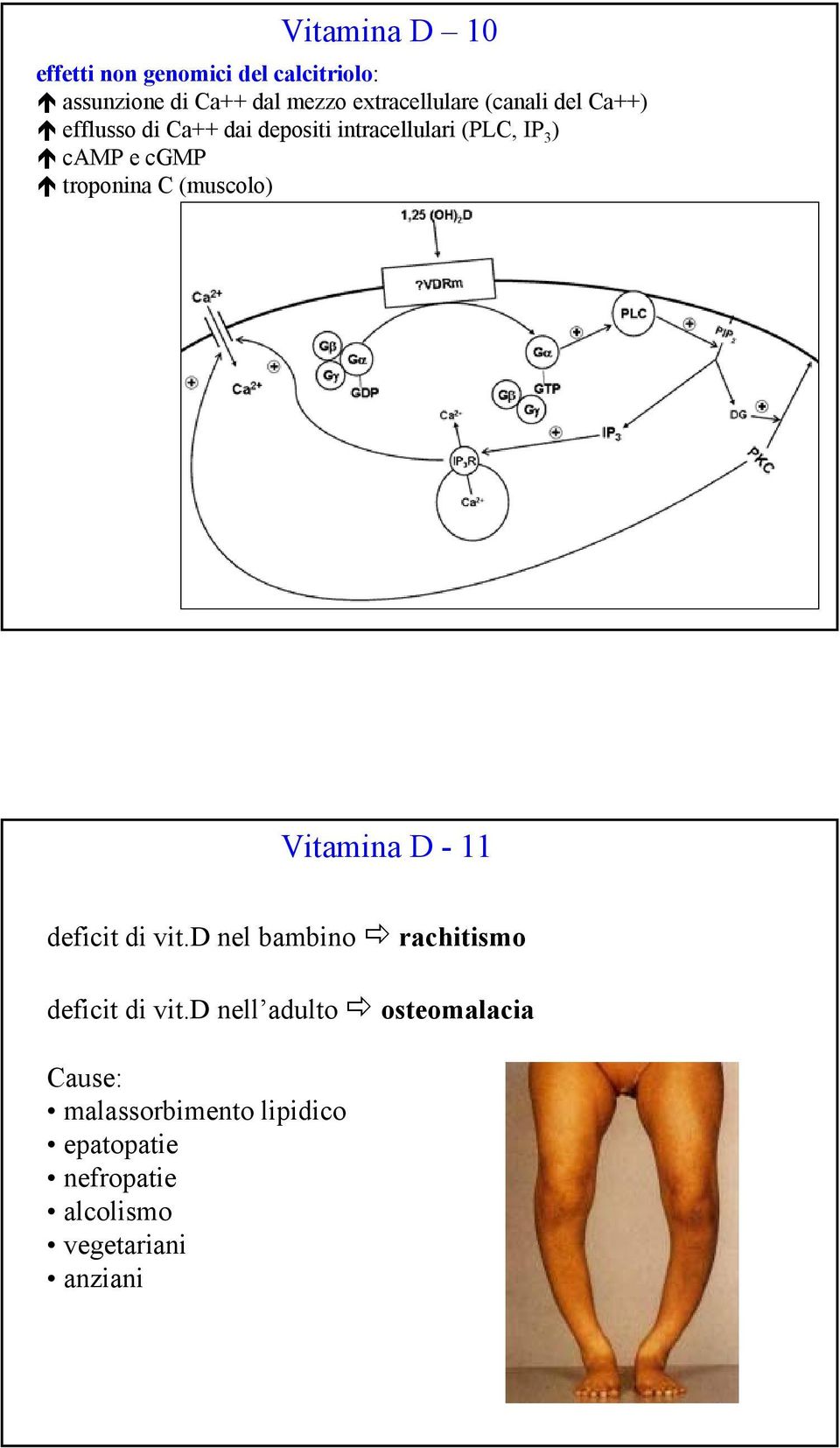 troponina C (muscolo) Vitamina D - 11 deficit di vit.d nel bambino rachitismo deficit di vit.