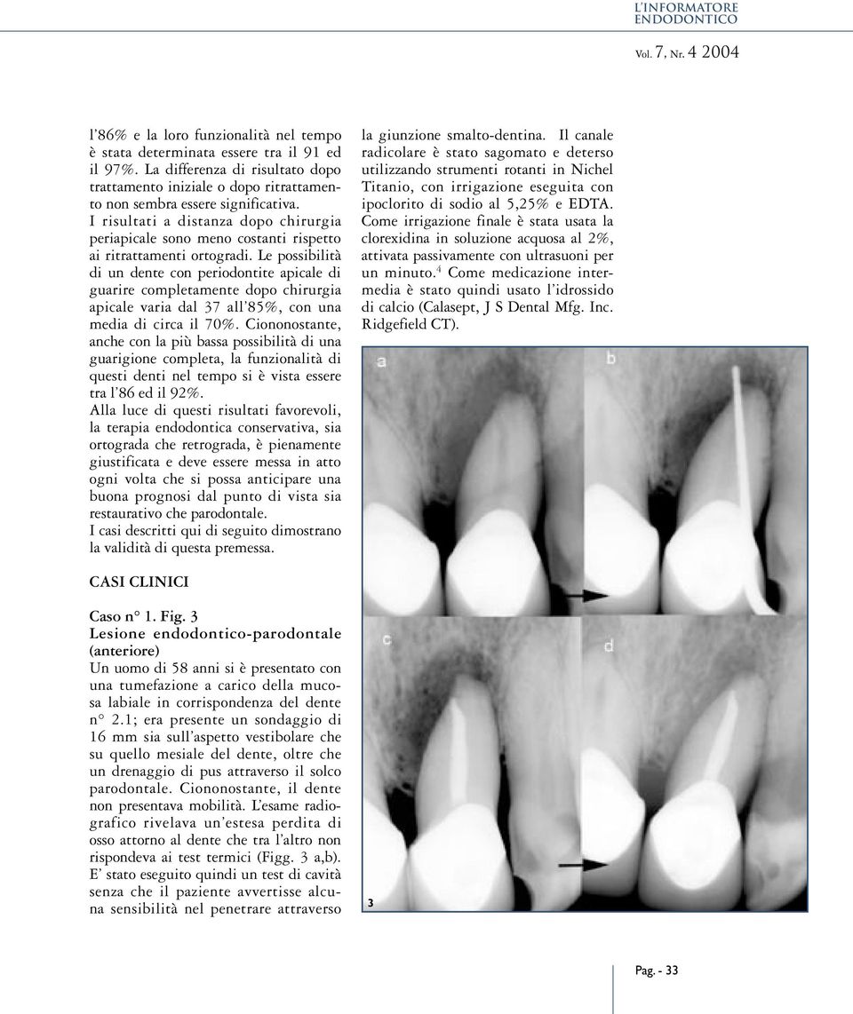 I risultati a distanza dopo chirurgia periapicale sono meno costanti rispetto ai ritrattamenti ortogradi.