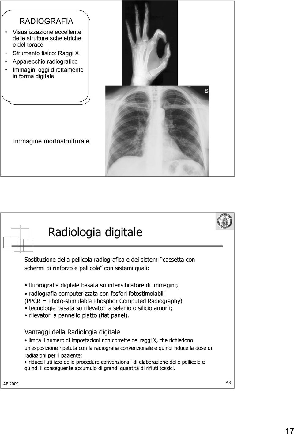 intensificatore di immagini; radiografia computerizzata con fosfori fotostimolabili (PPCR = Photo-stimulable Phosphor Computed Radiography) tecnologie basata su rilevatori a selenio o silicio amorfi;