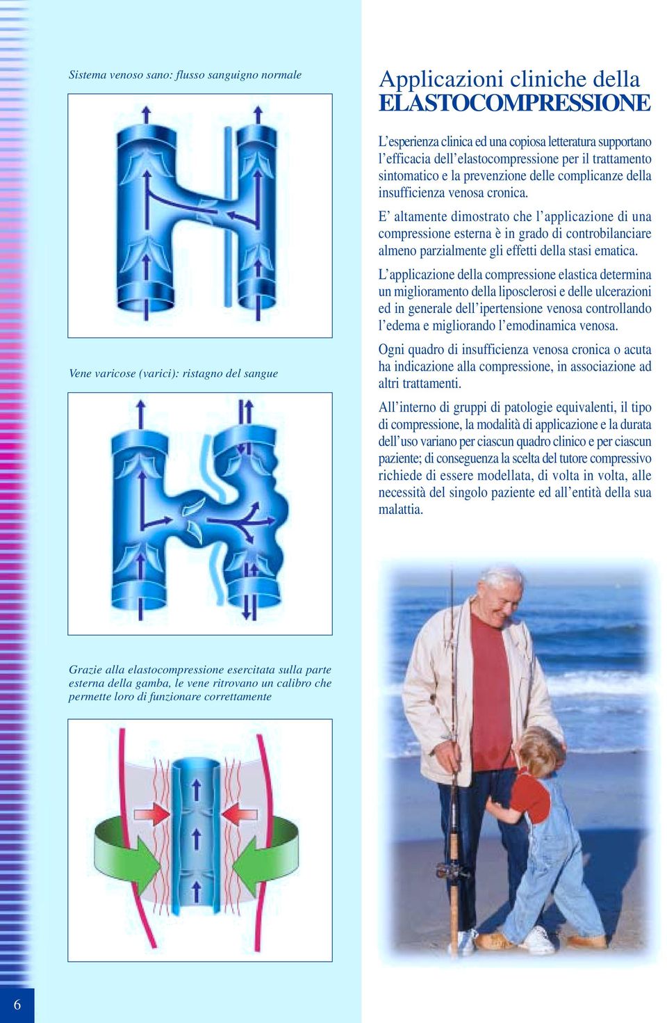 E altamente dimostrato che l applicazione di una compressione esterna è in grado di controbilanciare almeno parzialmente gli effetti della stasi ematica.