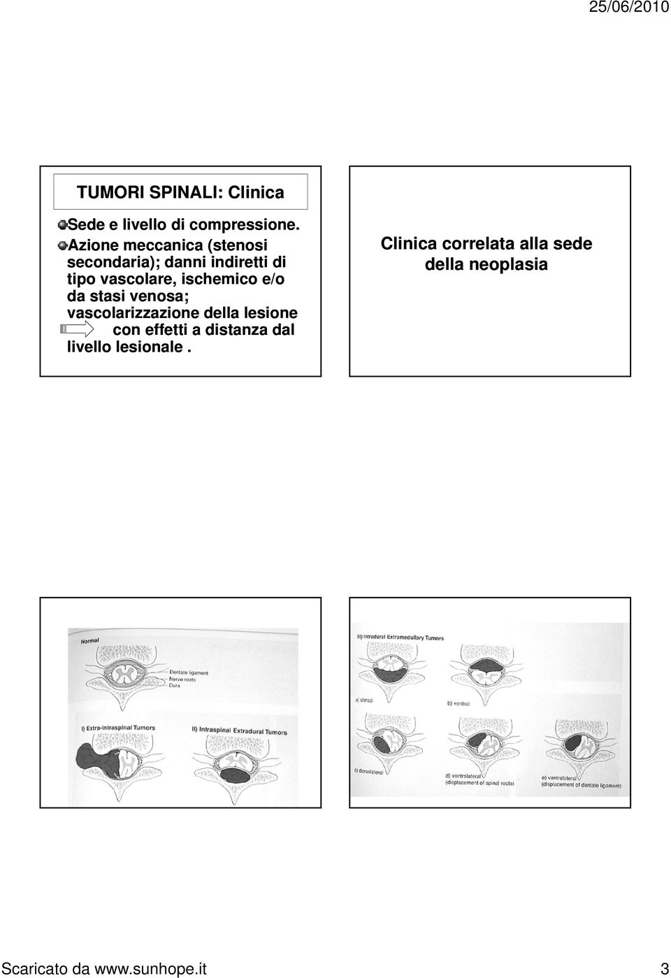 ischemico e/o da stasi venosa; vascolarizzazione della lesione con effetti a