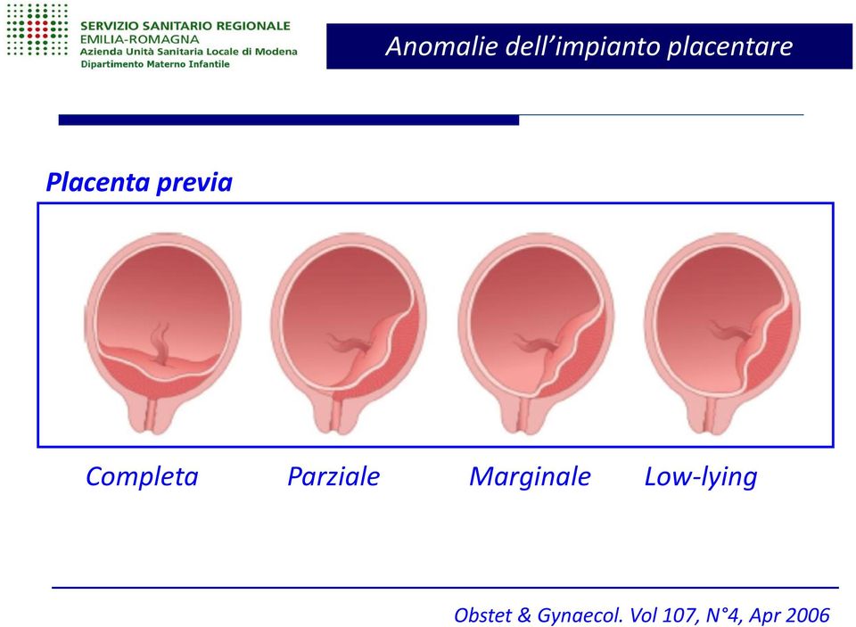 Completa Parziale Marginale