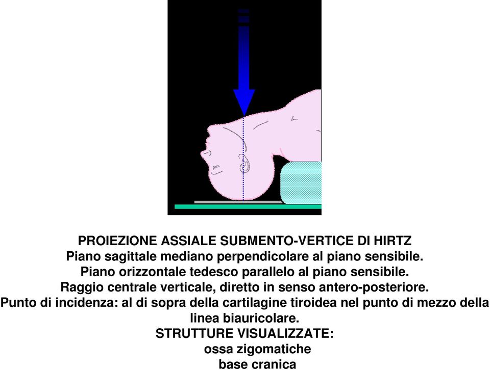 Raggio centrale verticale, diretto in senso antero-posteriore.