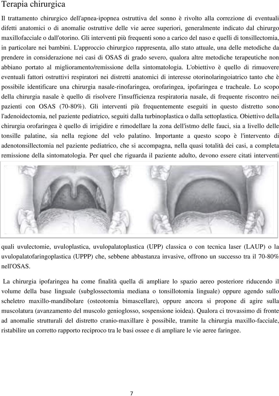 L'approccio chirurgico rappresenta, allo stato attuale, una delle metodiche da prendere in considerazione nei casi di OSAS di grado severo, qualora altre metodiche terapeutiche non abbiano portato al