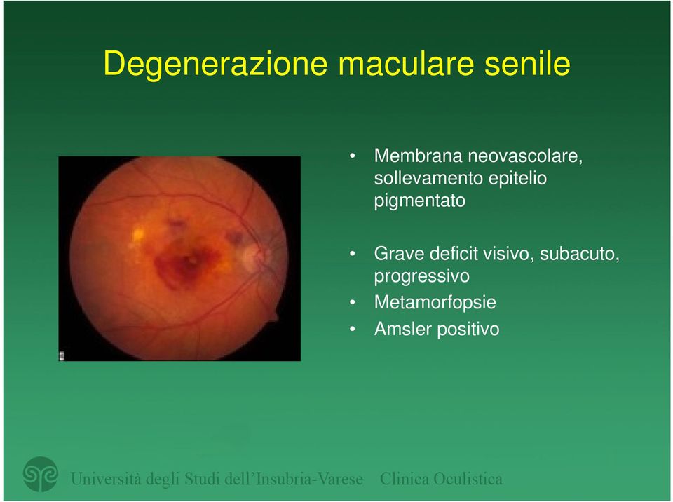 pigmentato Grave deficit visivo,