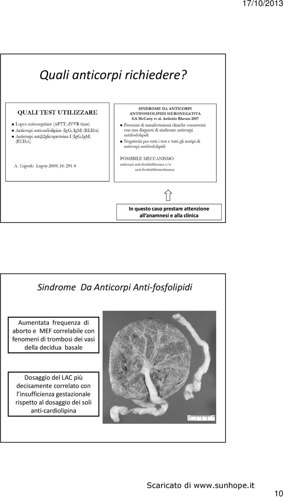 fosfolipidi Aumentata frequenza di aborto e MEF correlabile con fenomeni di trombosi dei