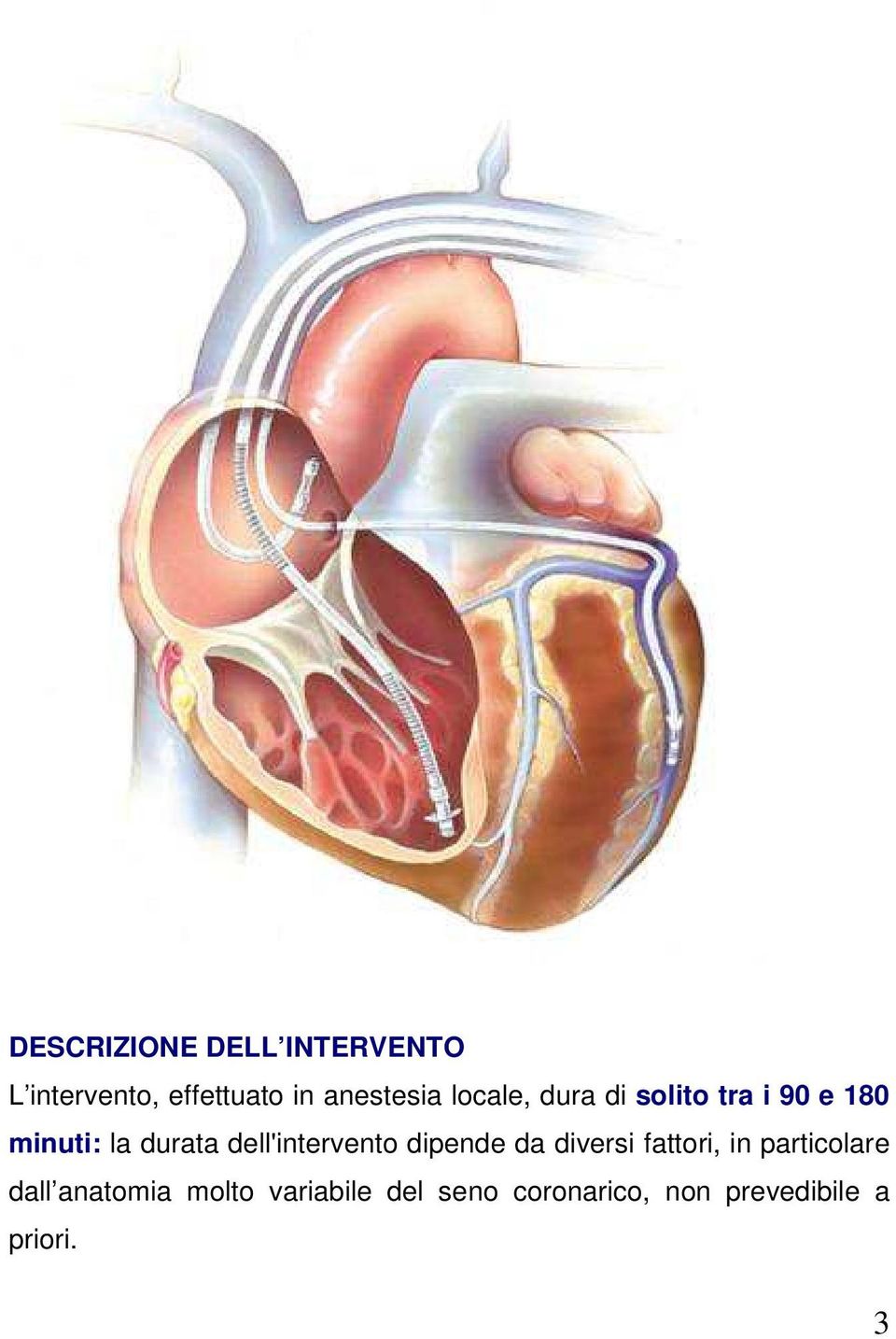 durata dell'intervento dipende da diversi fattori, in