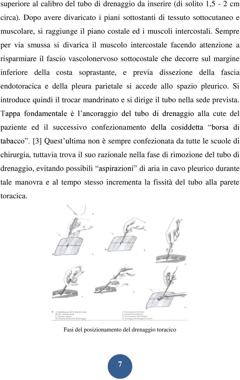 Sempre per via smussa si divarica il muscolo intercostale facendo attenzione a risparmiare il fascio vascolonervoso sottocostale che decorre sul margine inferiore della costa soprastante, e previa