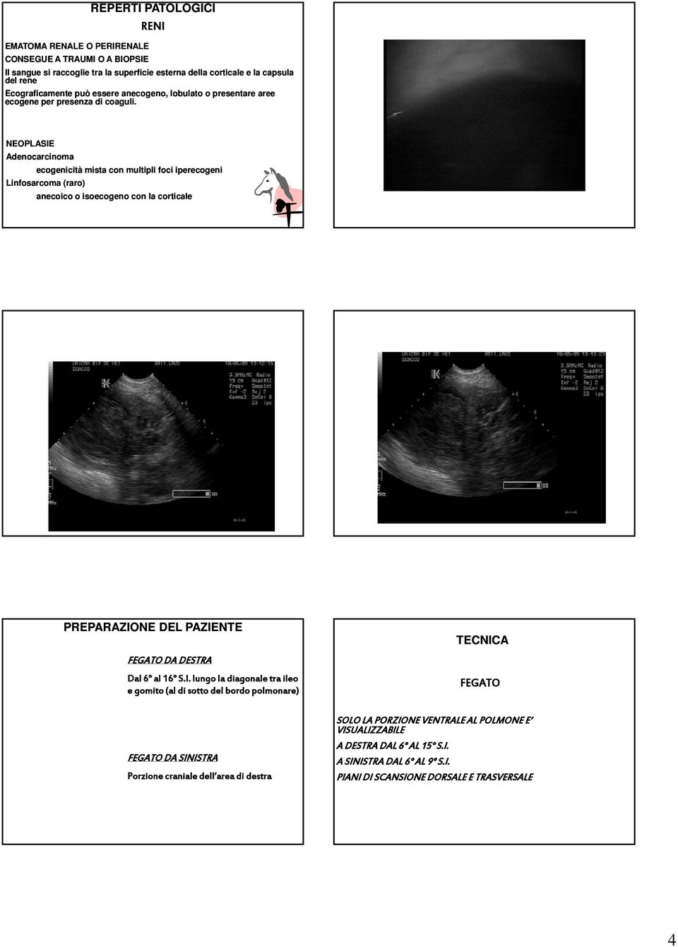 NEOPLASIE Adenocarcinoma ecogenicità mista con multipli foci iperecogeni Linfosarcoma (raro) anecoico o isoecogeno con la corticale PREPARAZIONE DEL PAZIENTE DA DESTRA Dal 6 al