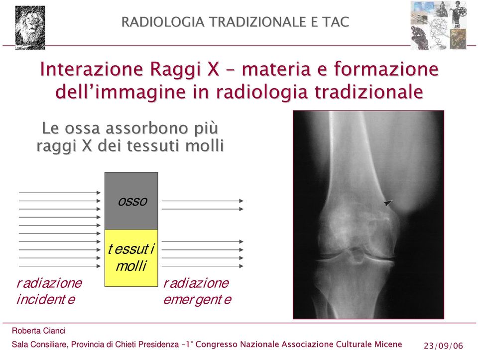 assorbono più raggi X dei tessuti molli osso