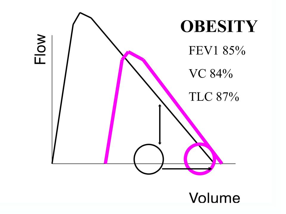 VC 84%