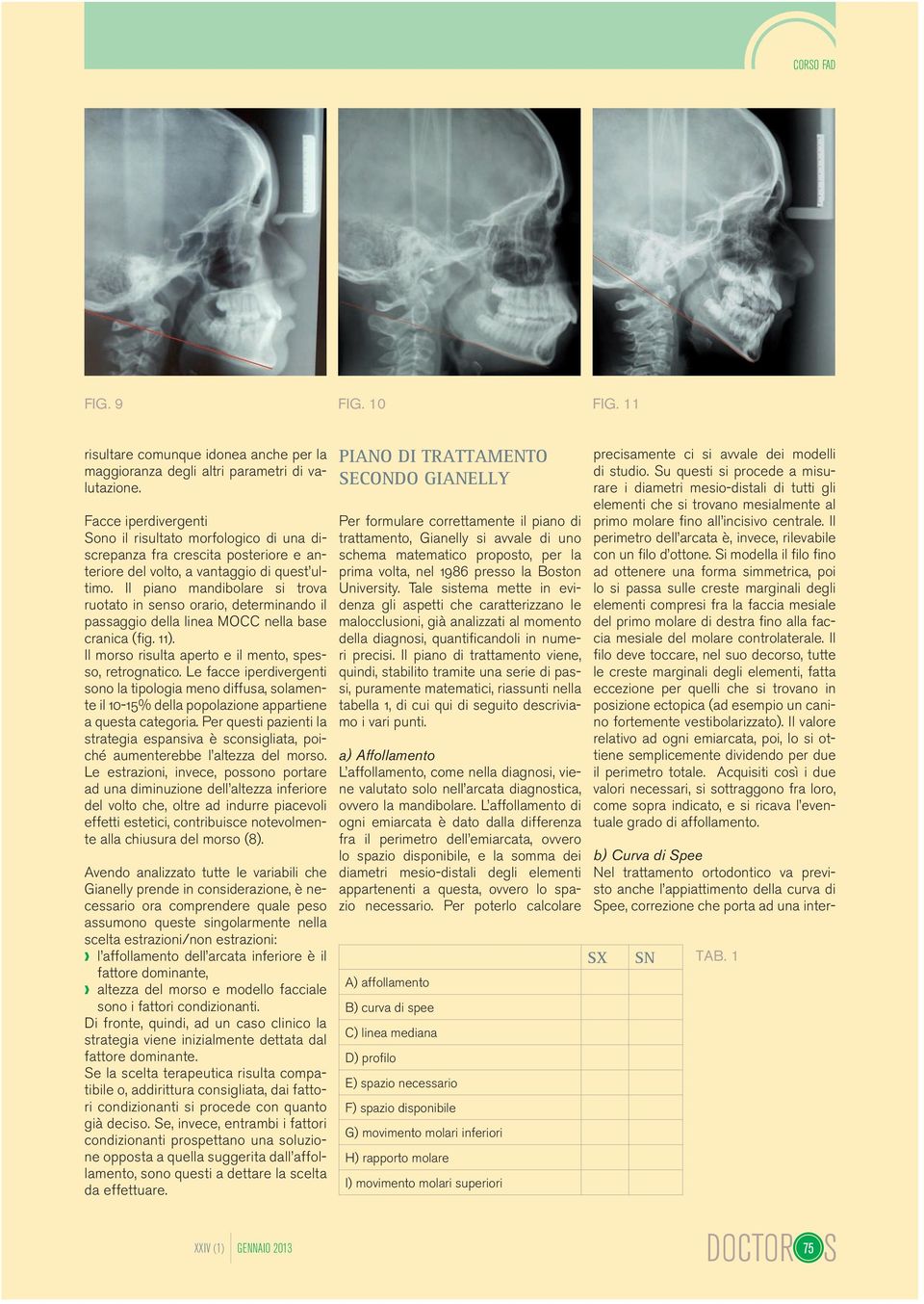 Il piano mandibolare si trova ruotato in senso orario, determinando il passaggio della linea MOCC nella base cranica (fig. 11). Il morso risulta aperto e il mento, spesso, retrognatico.